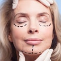 The Ultimate Guide to Cosmetic Surgery: What You Need to Know