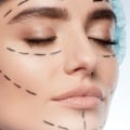 The Ultimate Guide to Plastic Surgery: From an Expert's Perspective